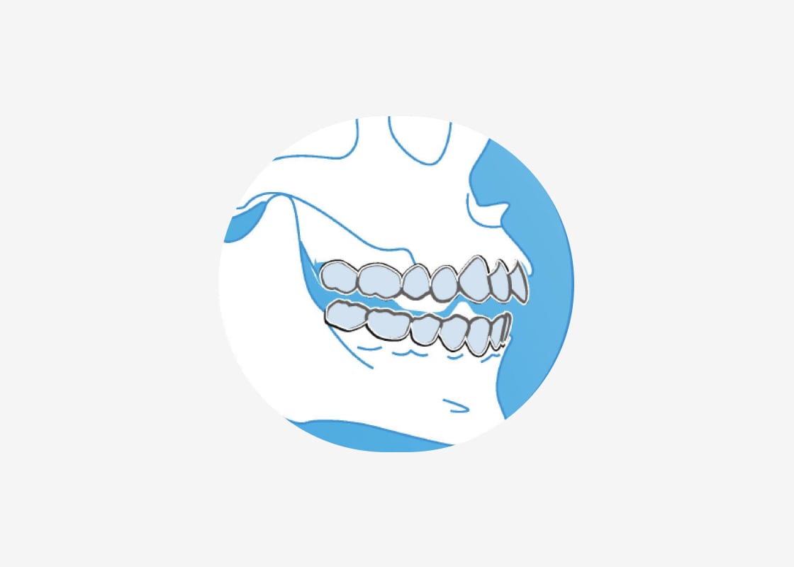 photo Combine two orthodontic phases into one