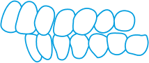 A simple illustration shows an overbite, with the upper front teeth significantly overlapping the lower front teeth. The teeth are outlined in blue.